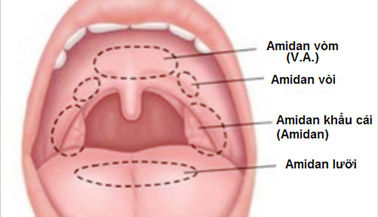 Amidan là gì, giải phẫu cấu tạo của amidan