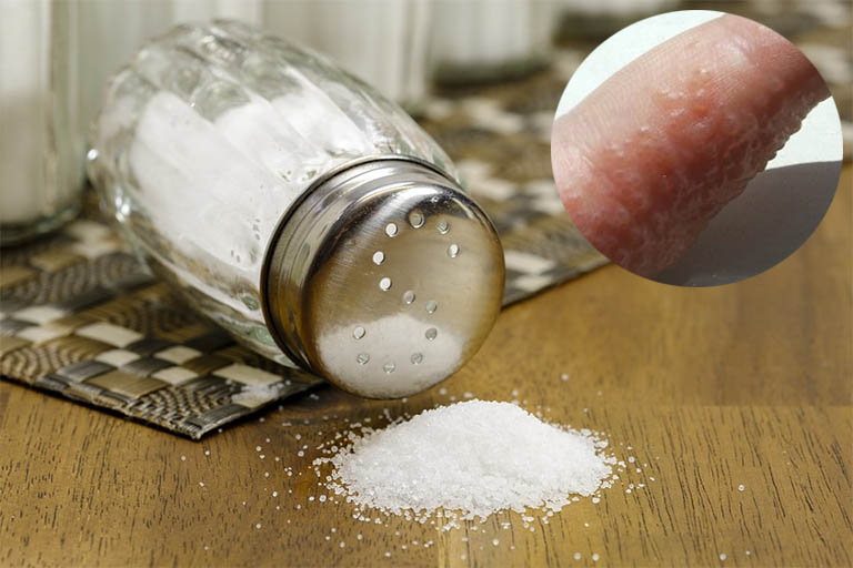 công dụng của muối trong việc chữa bệnh tổ đỉa