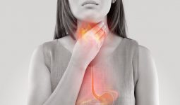 Viêm họng do trào ngược dạ dày thực quản là chứng bệnh phổ biến