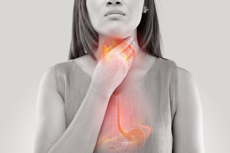 Viêm họng do trào ngược dạ dày thực quản là chứng bệnh phổ biến