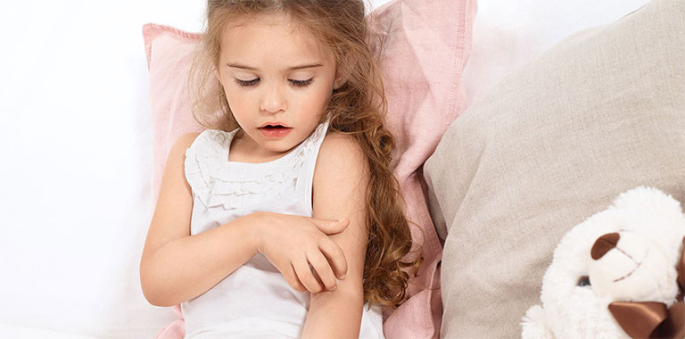 viêm da ở trẻ em có nguy hiểm không