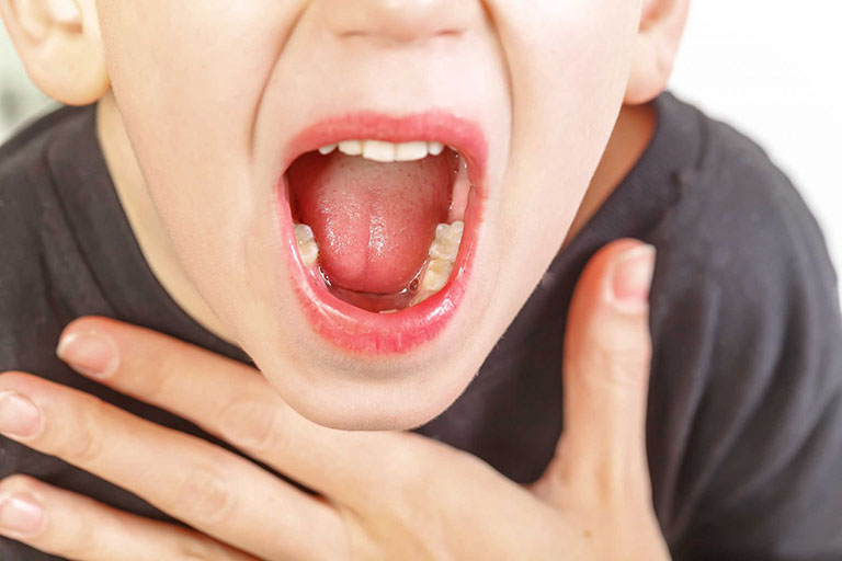 Viêm họng ở trẻ em là căn bệnh hô hấp thường gặp