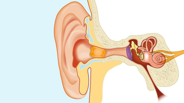 Ráy tai tích tụ có thể gây đau tai mức độ nhẹ, giảm thính lực và ù tai