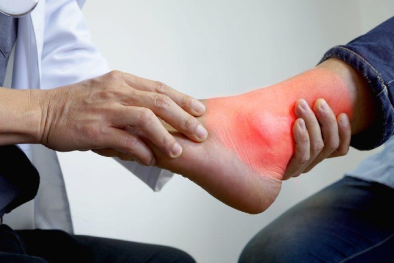 Đau khớp cổ chân khi ngủ dậy khiến khả năng vận động của người bệnh bị hạn chế 