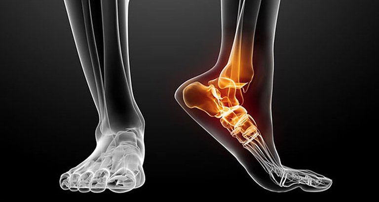 Mắc các bệnh lý về xương khớp cũng là nguyên nhân gây đau khớp cổ chân khi ngủ dậy