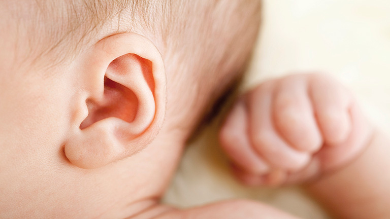 Viêm tai giữa thanh dịch là tình trạng ứ đọng mãn tính dịch mủ trong hòm nhĩ