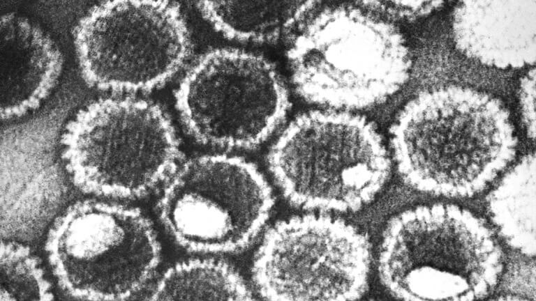 Hình ảnh zona virus dưới kính hiển vi