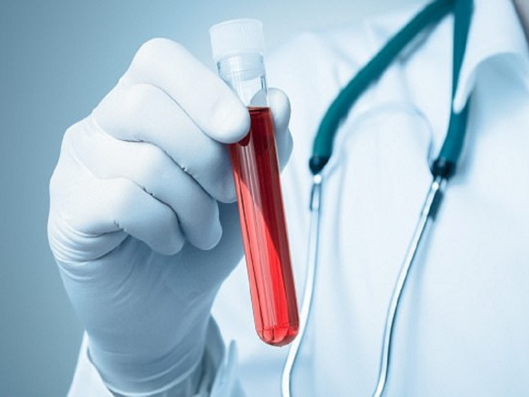 Xét nghiệm máu là một biện pháp chẩn đoán hiệu quả