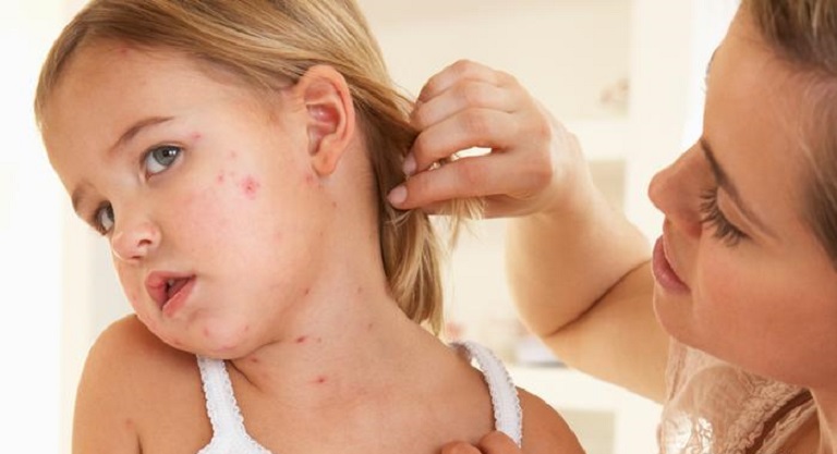 Bệnh có thể do yếu tố di truyền từ bố mẹ sang con cái