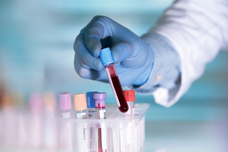 Xét nghiệm máu là một biện pháp sử dụng để chẩn đoán bệnh