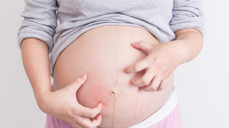 Mẹ bầu mang thai sức đề kháng yếu dẫn đến thời gian điều trị thường lâu hơn