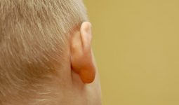 Mọc hạch sau tai ở bệnh nhân ung thư thường không gây đau, nên dễ bị coi thường và bỏ qua