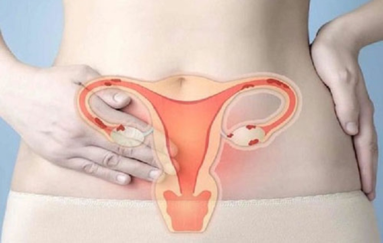 Bệnh phụ khoa là các vấn đề gặp phải tại cơ quan sinh sản nữ giới