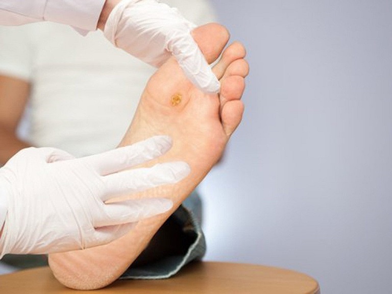 Kiểm tra và chăm sóc bàn chân mỗi ngày