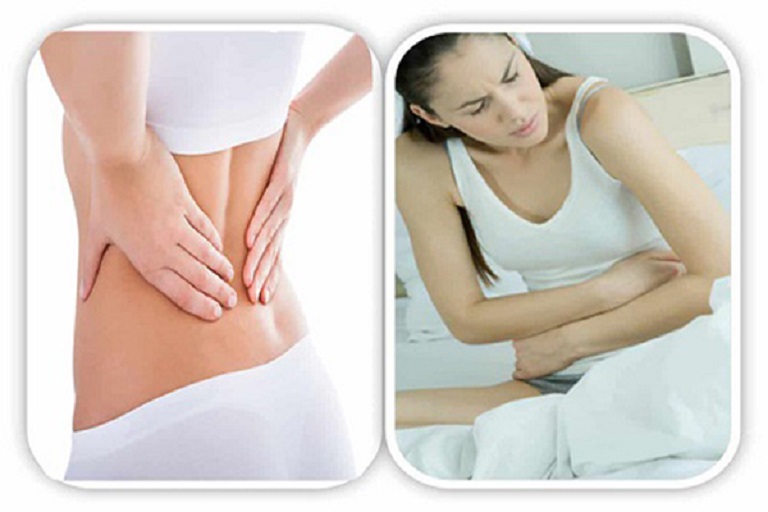 Đau lưng ra huyết nâu kèm đau bụng là một hiện tượng hay gặp ở chị em phụ nữ