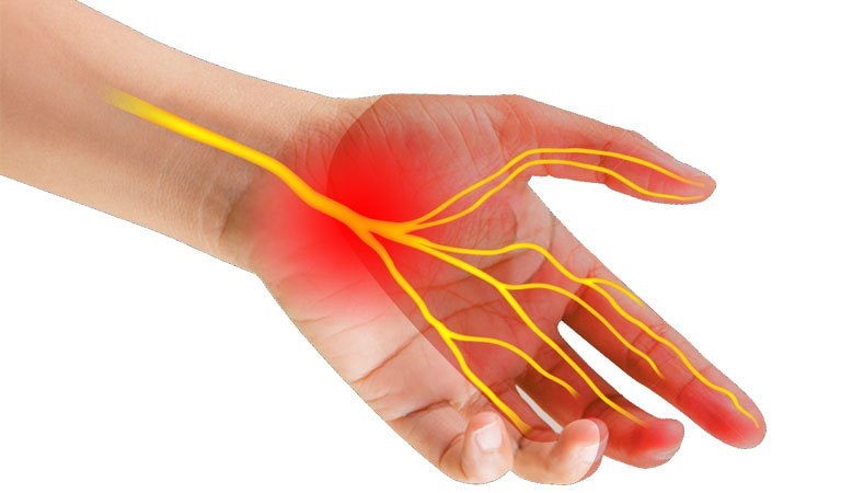 Bệnh tê tay thường liên quan tới các dây thần kinh cảm giác ở bàn tay