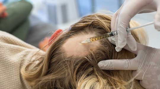 Tiêm corticosteroid có thể mang lại nhiều tác dụng phụ