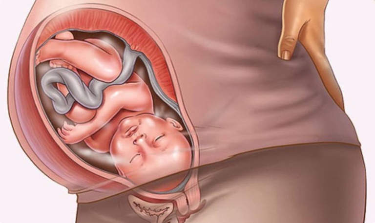 Mang thai khi bị viêm phụ khoa sẽ ảnh hưởng không tốt đến cả thai nhi và thai phụ