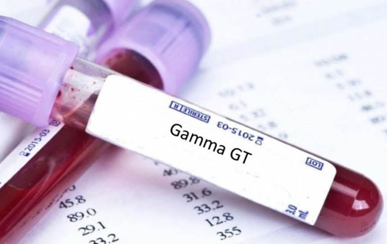 Xét nghiệm đo chỉ số GGT trong máu được chỉ định với mục đích kiểm tra sức khỏe và chức năng gan