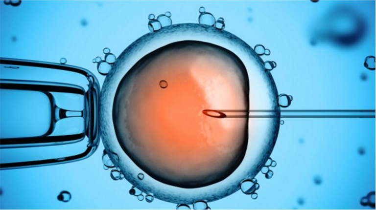 Thụ tinh trong ống nghiệm khắc phục chứng buồng trứng có nhiều nang nhỏ