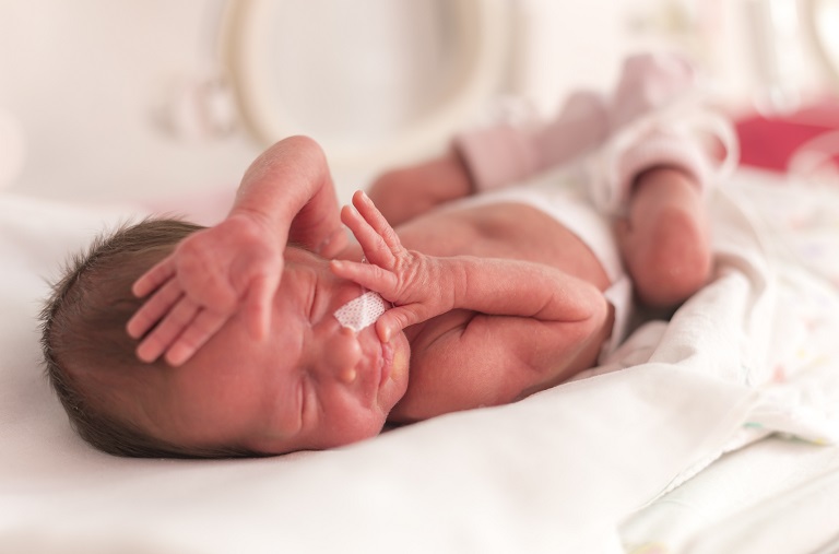 Em bé sơ sinh có thể bị mắc nhiều hội chứng nguy hiểm sau sinh
