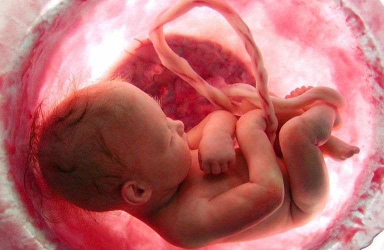 Khối u trong tử cung có thể chèn ép lên thai nhỉ
