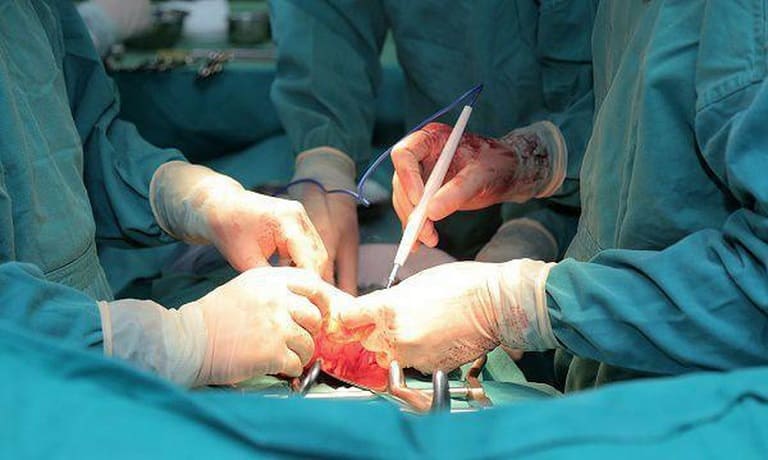 Phẫu thuật điều trị ung thư buồng trứng 