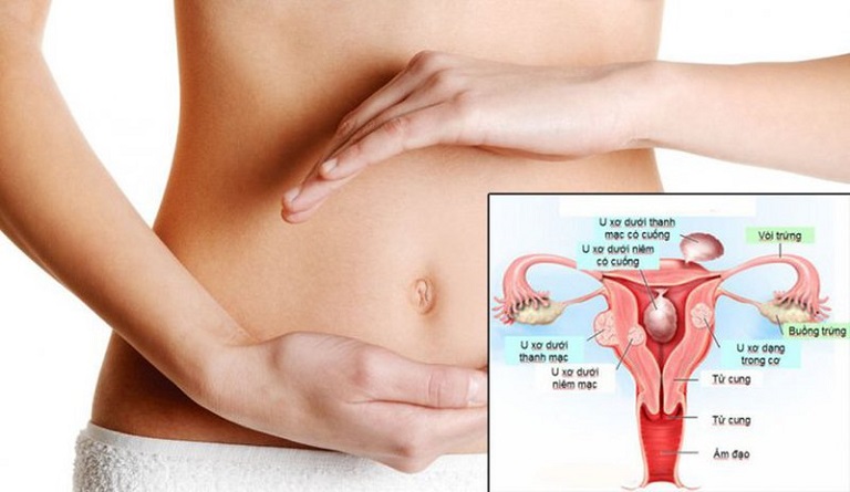 Phụ nữ trong giai đoạn sinh sản nên đi khám phụ khoa 