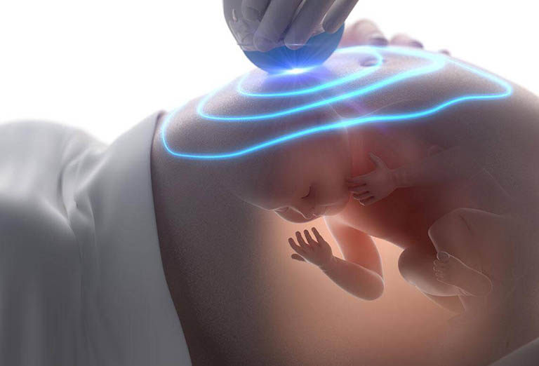 Đo độ mờ da gáy là kỹ thuật được sử dụng để chẩn đoán hội chứng Down hoặc nguy cơ mắc bệnh sớm nhất trong thời kỳ mang thai