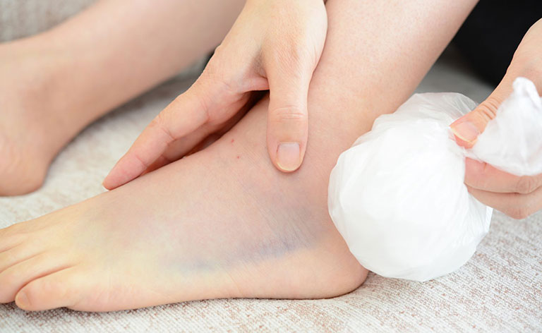 cách chữa bệnh gai gót chân tại nhà