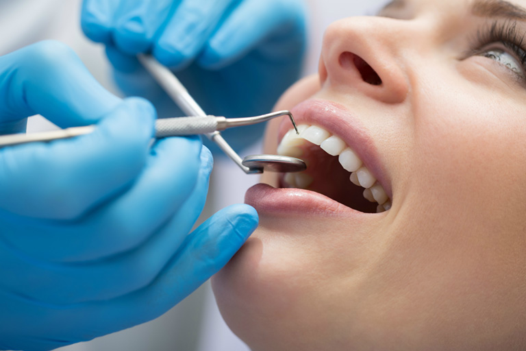 viêm nướu răng cách điều trị