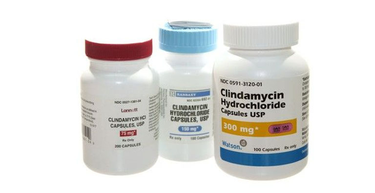 Thuốc Clindamycin điều trị áp xe răng