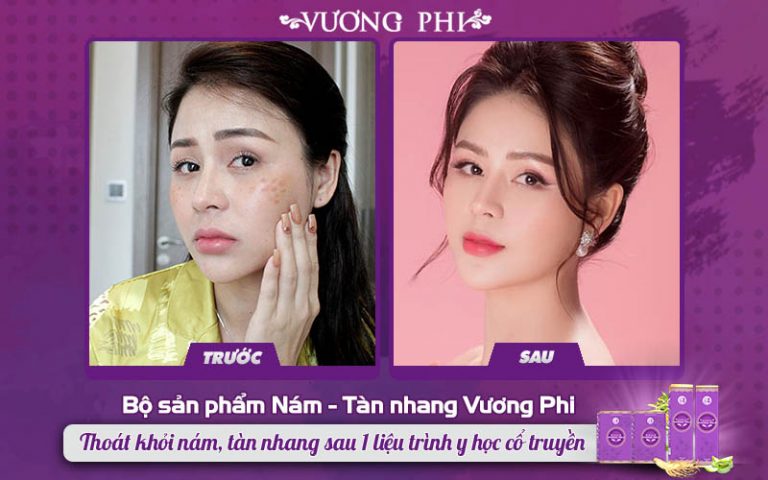 Làn da của diễn viên Thu Trang cải thiện rõ rệt sau 3 tháng dùng bộ Vương Phi