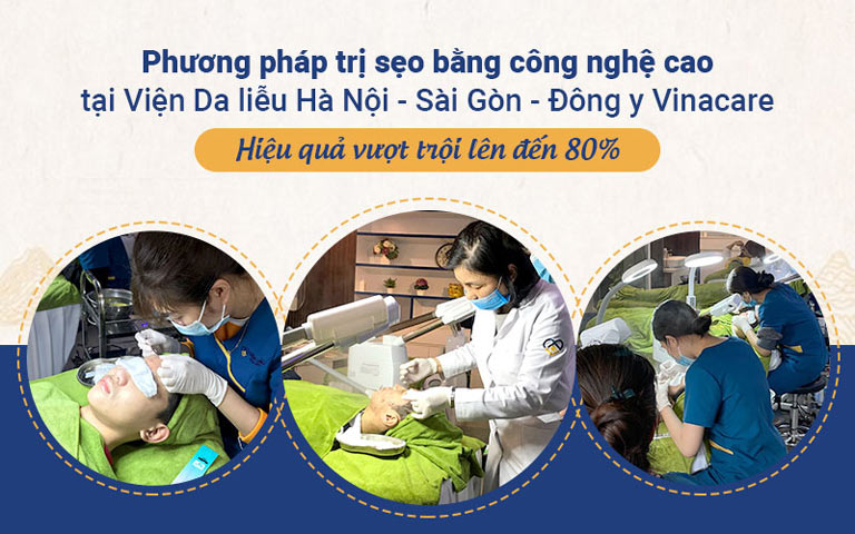 Phương pháp trị sẹo của Viện Da liễu Hà Nội - Sài Gòn được đánh giá cao về chất lượng