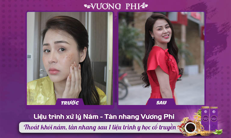 Sự thay đổi về làn da của diễn viên Lương Thu Trang sau 3 tháng sử dụng Vương Phi