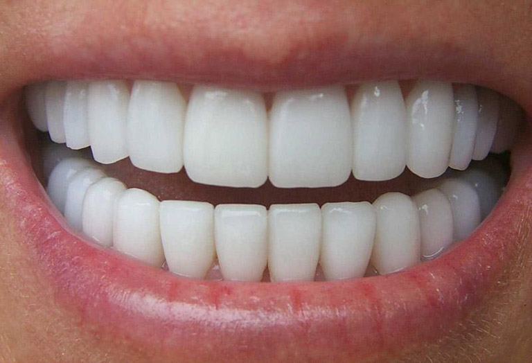 Răng sứ Zirconia